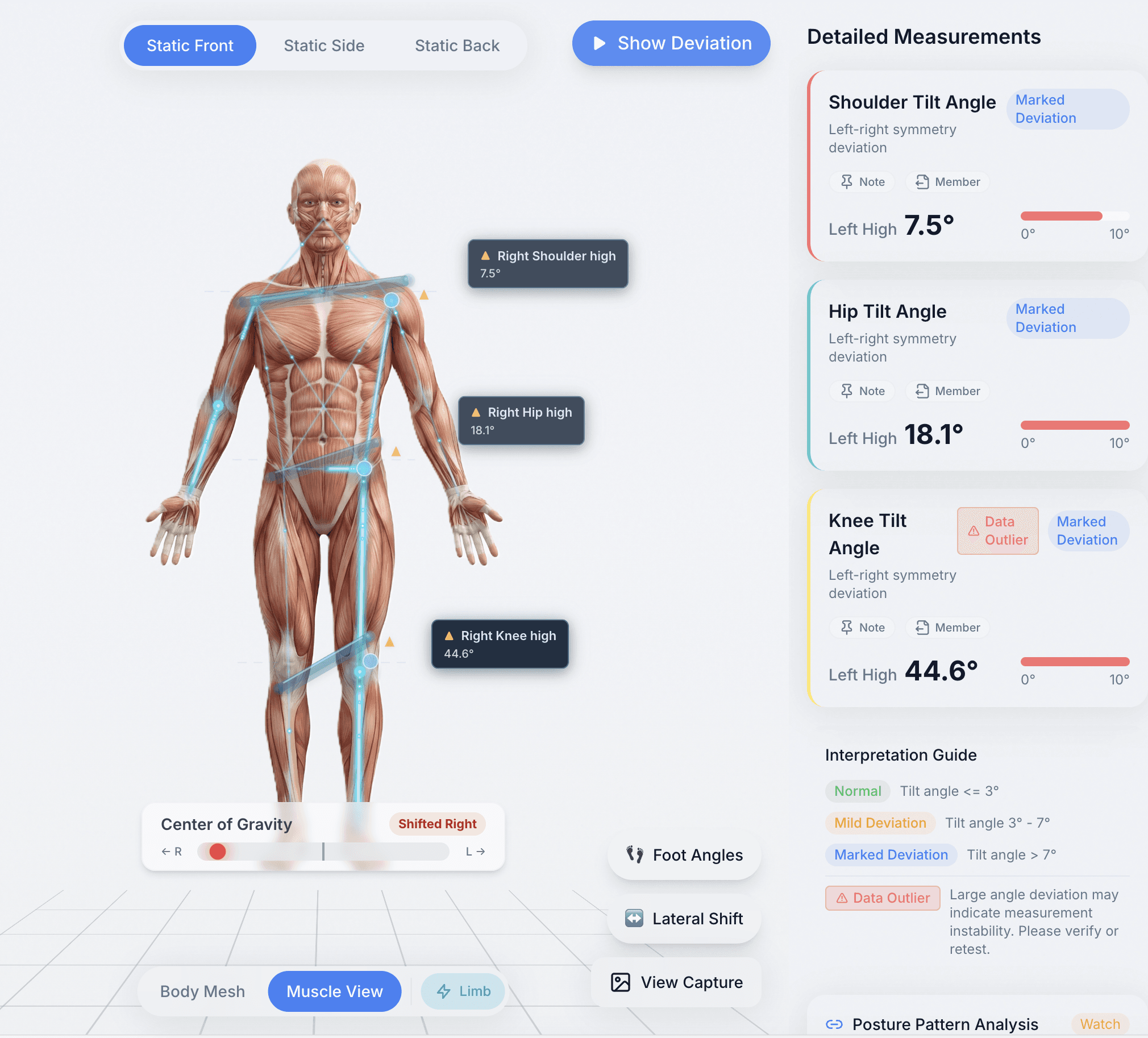 Crosspoint AI 體態評估產品畫面