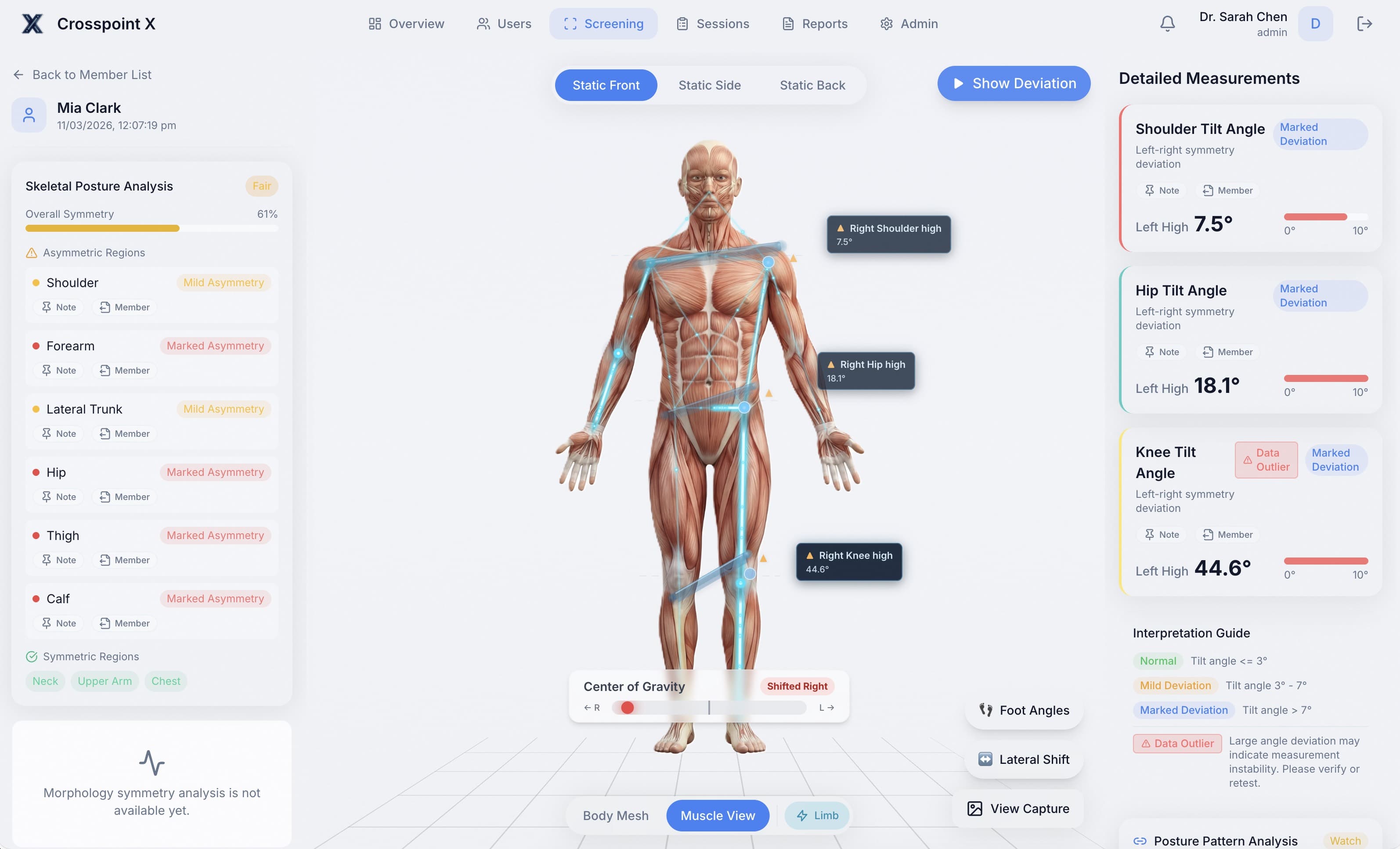Crosspoint 產品畫面